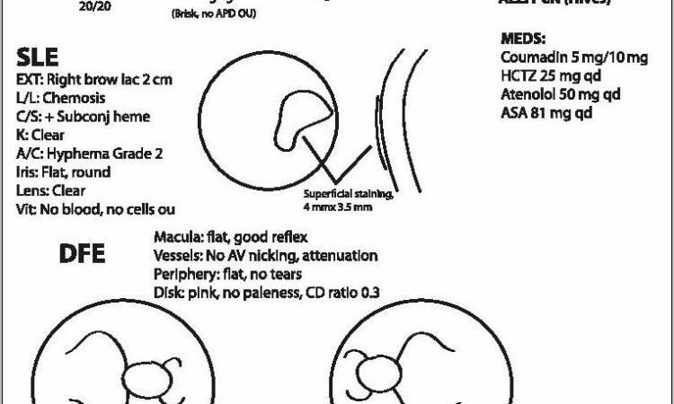 Writing Nursing Progress Notes Example