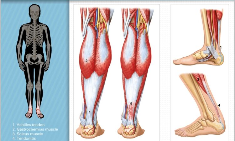 Achilles Tendon Anatomy Diagram