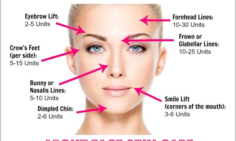 Botox Face Diagram Pdf