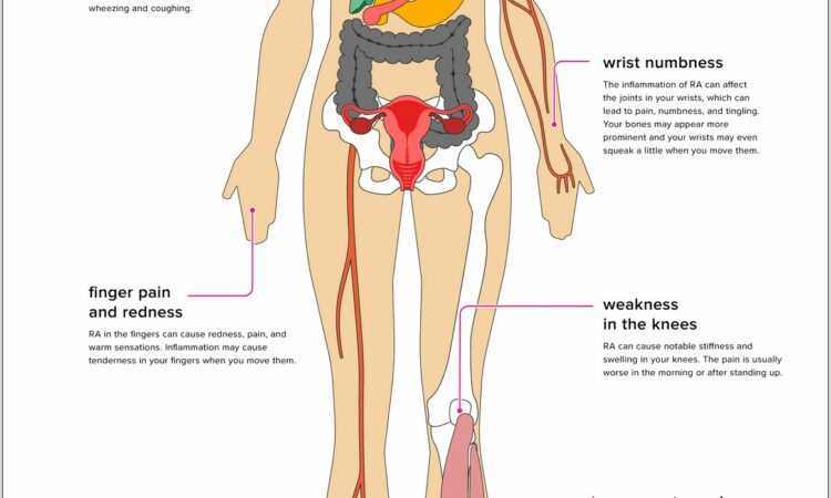 Heart Pain Location Diagram